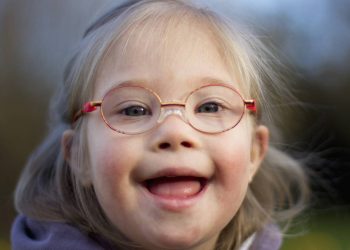 Down Sendromu Nedir? Teşhisi ve Belirtileri