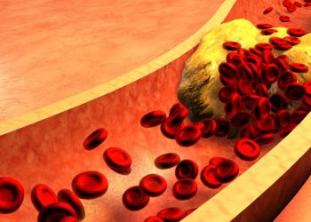 Kolesterol Nedir? Nasıl Düşürülür?