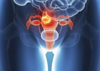 Rahim Kanseri Belirtileri Ve Tedavisi