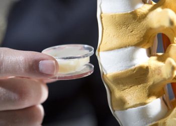 Bel Fıtığı Belirtileri ve Tedavisi