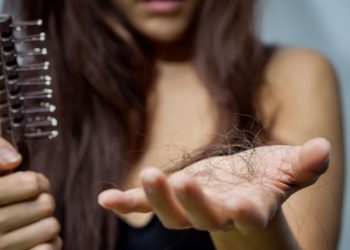 Kadınlarda Saç Dökülmesi